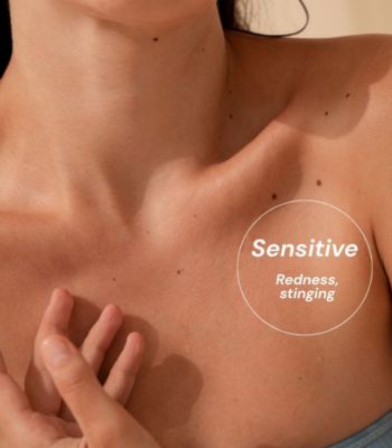 Alergeni u kozmetici